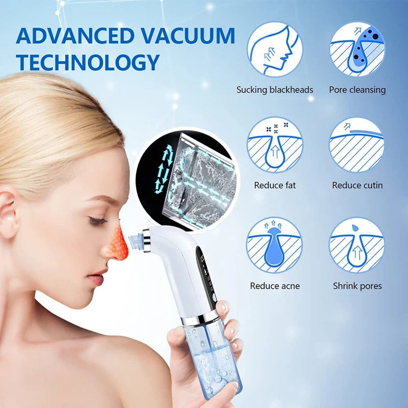 Electric Blackhead Remover