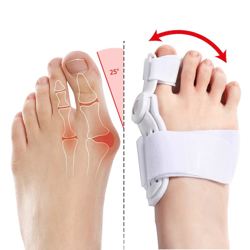 ComfortAlign 2Pcs Hallux Valgus and Bunion Corrector – Orthopedic Toe Separator and Foot Care Solution