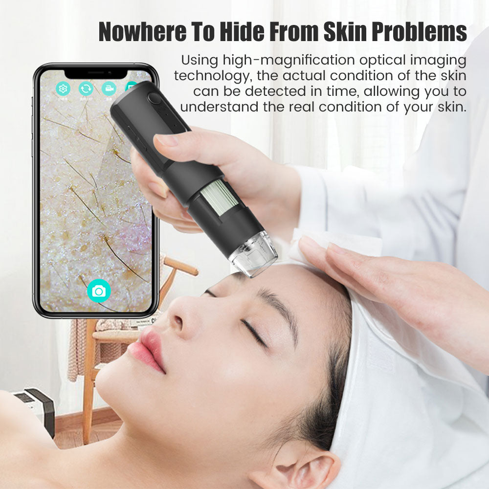 Wireless Dermatoscope Analyzer