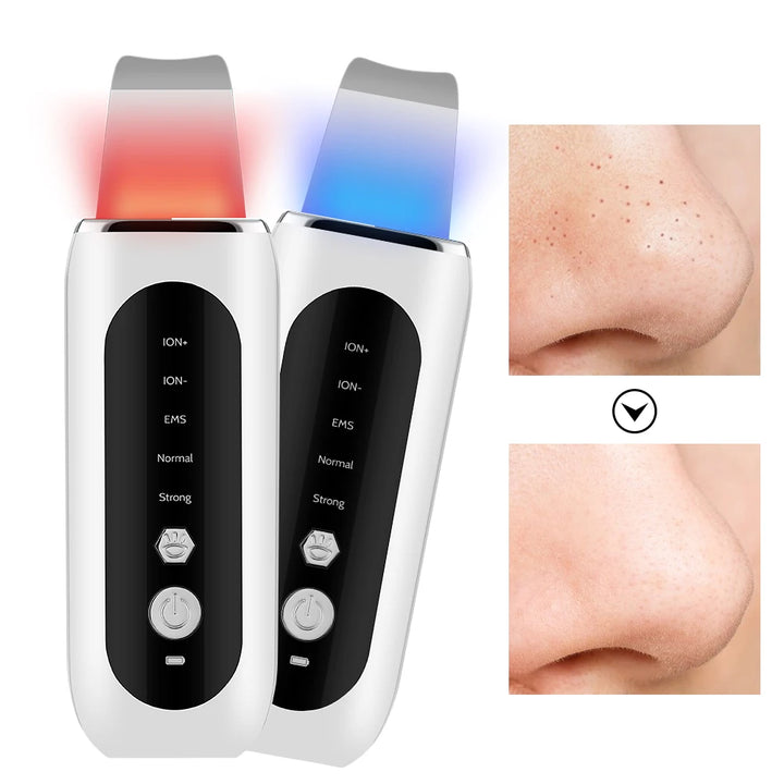 Ultrasonic Skin Scrubber