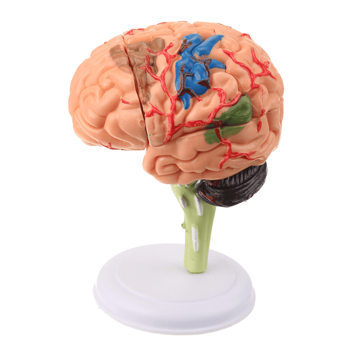 Human Brain Medical Model 4D Disassembled Anatomical School Educational Teaching Tool - MRSLM